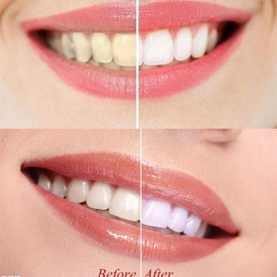 Bamboo Charcoal Teeth Tooth De - Teeth Whitening Kit recension och pris
