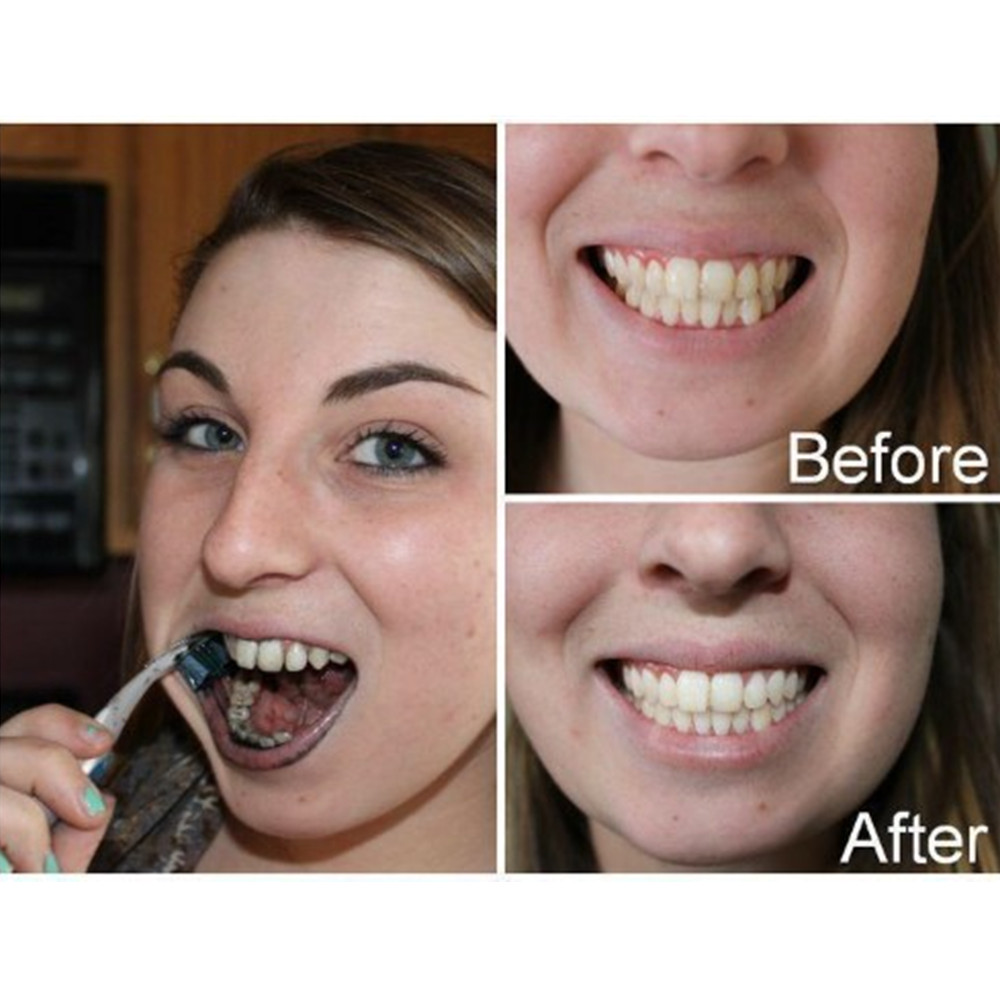 Bamboo Charcoal Teeth Tooth De - Teeth Whitening Kit recension och pris