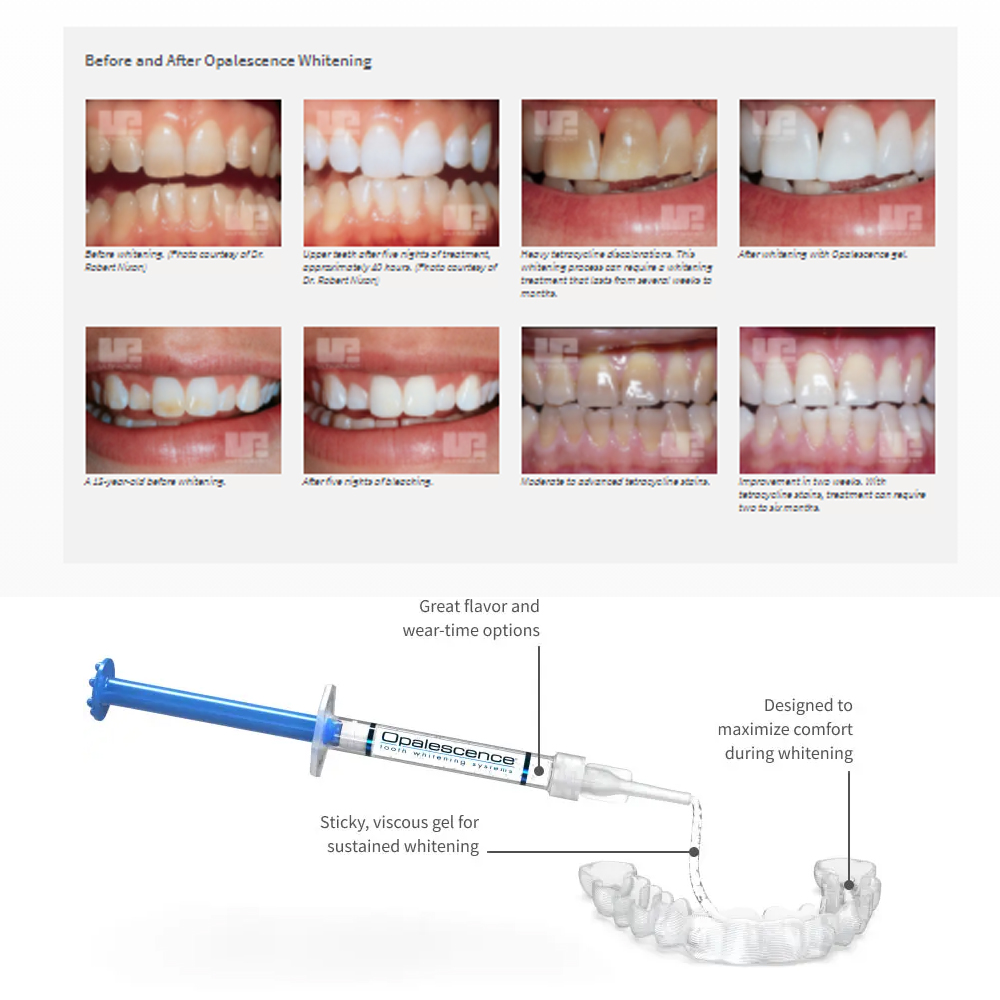 Opalescence Whitening 20% PF 2 - Teeth Whitening Kit recension och pris
