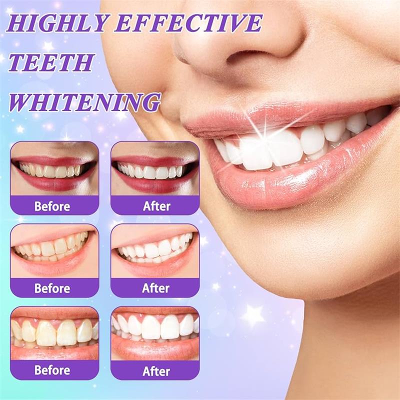 9D Purple Teeth Whitening Toot - Teeth Whitening Pens recension och pris