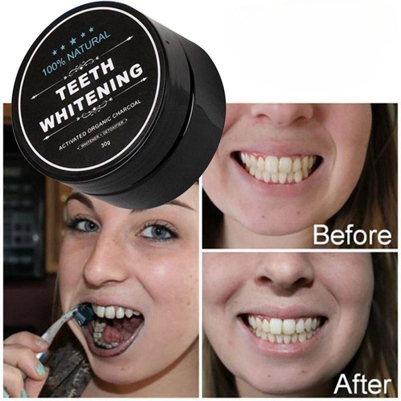 1 Box Activated Charcoal Teeth - Teeth Whitening Near Me recension och pris